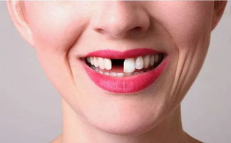 夏洛特夫人怎么种植